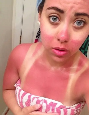 Redskin.jpg